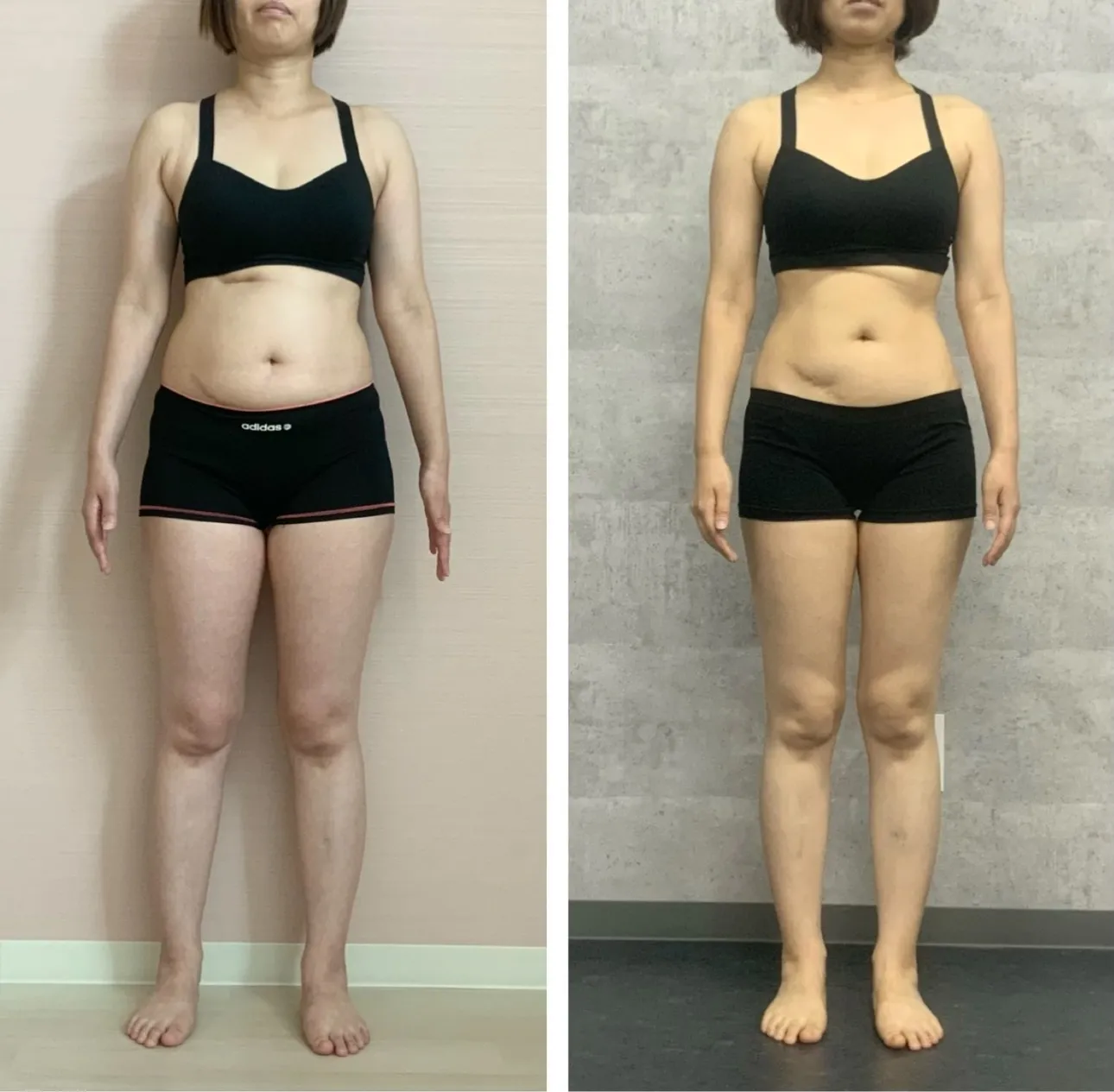 肩こりむくみ改善・ダイエット・ピラティス【39歳・M.O様】