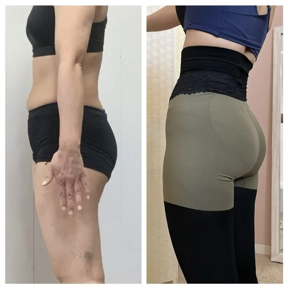 尿もれ改善・ダイエット・トレーニング【５２歳・M.S様】