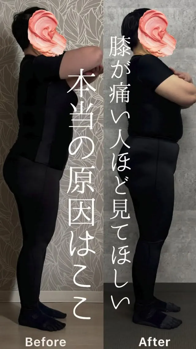 「膝が痛くて、もう思いきり動けない…」